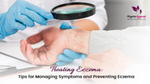 Read more about the article Treating Eczema: Tips for Managing Symptoms and Preventing Eczema