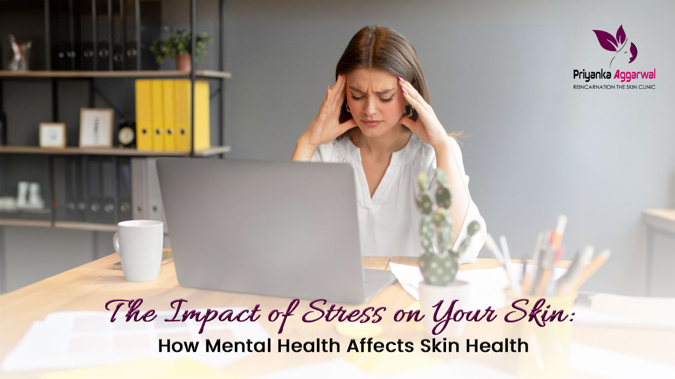 Read more about the article The Impact of Stress on Your Skin: How Mental Health Affects Skin Health